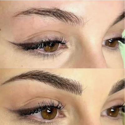 Comparison of eyebrows before and after grooming.