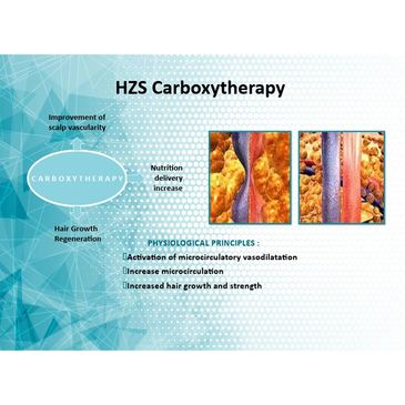 Carboxytherapy vascular improvement image