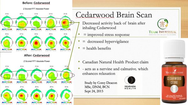 Brain Scans before and after using YL oils!
