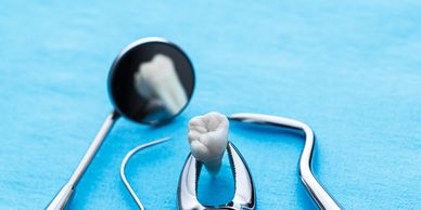 tooth extraction, tooth surgery, pull tooth, wisdom tooth, rotten tooth, oral surgery
