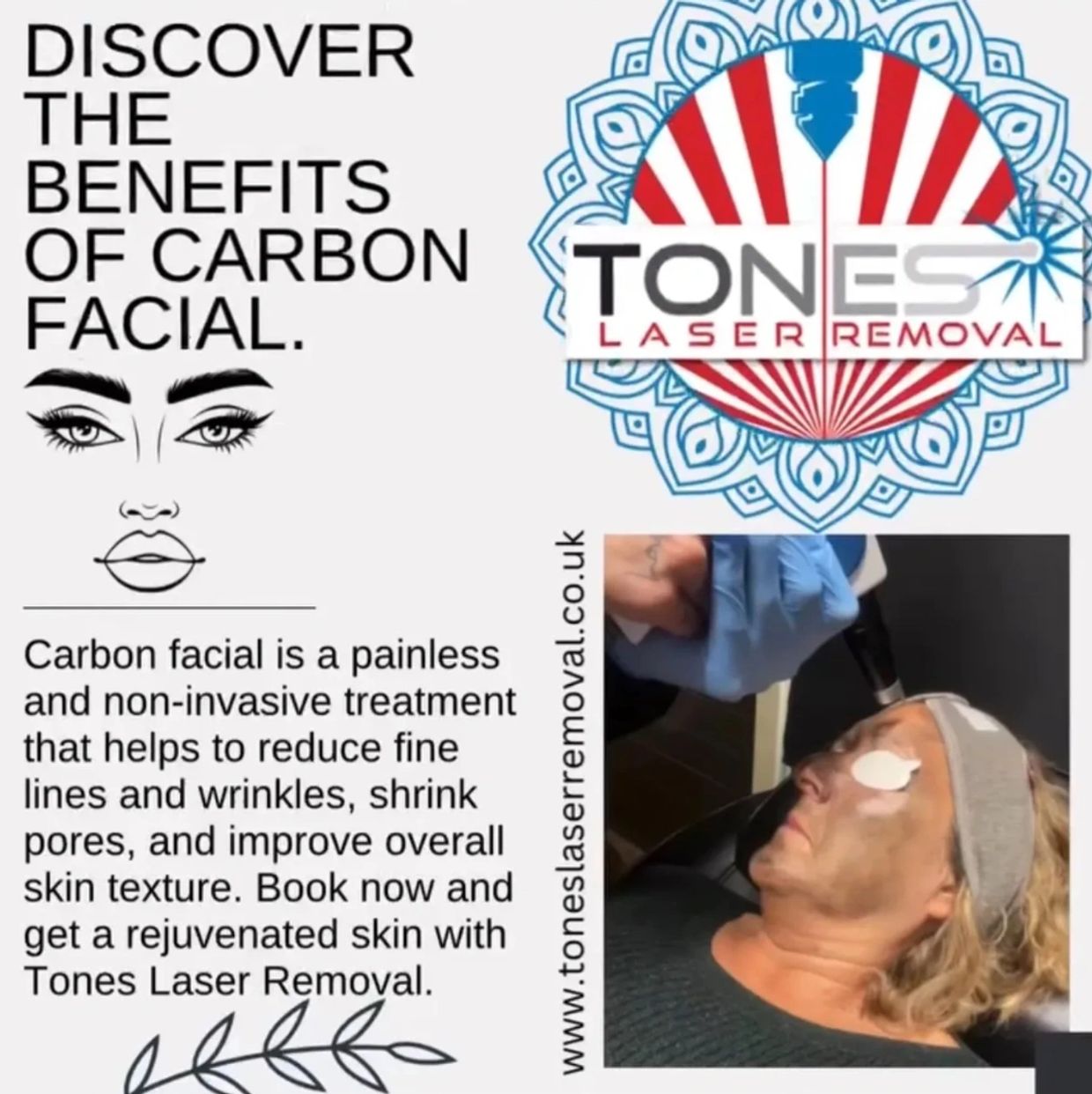Carbon laser facial treatment exfoliating and rejuvenating skin in Hythe