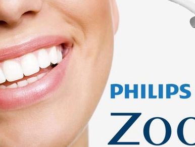 Image of the best professional teeth whitening Zoom 