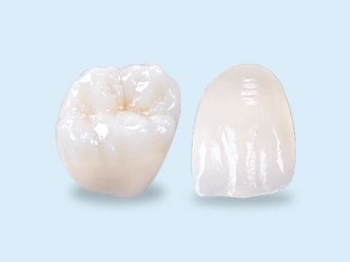 Image of a dental crown and a veneer