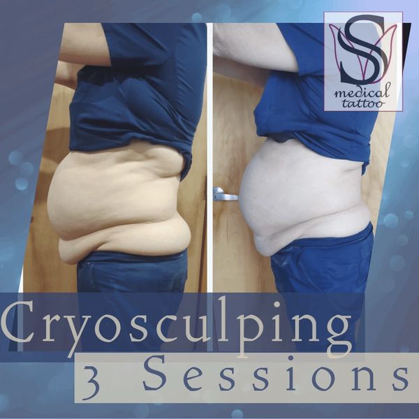 weight loss injections near me