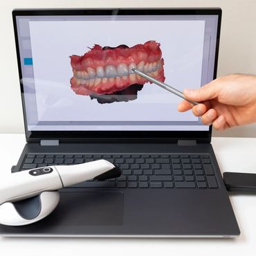 Digital dental scan displayed on a laptop with a handheld scanner and a pointing tool.