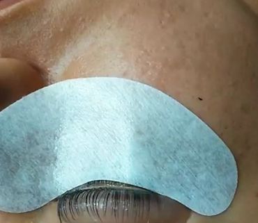 Close-up of an eyelash extension process with eye pad applied.