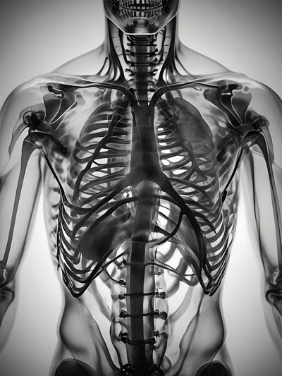 Detailed X-ray image showing the upper torso skeleton and rib cage.