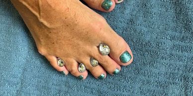 Feet with metallic toe separators and green nail polish on a blue towel.