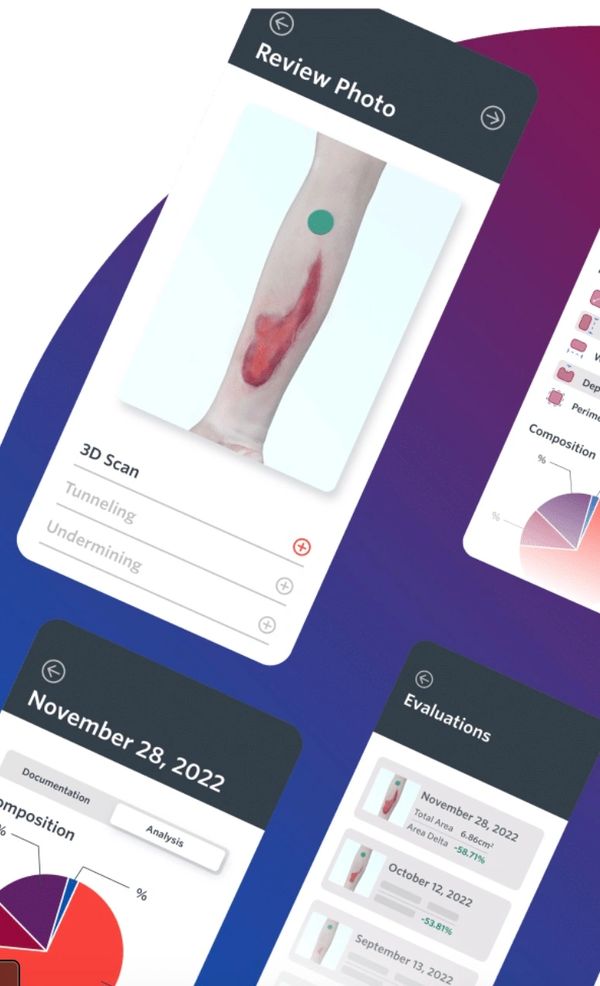 Medical app showing wound analysis and evaluation data.