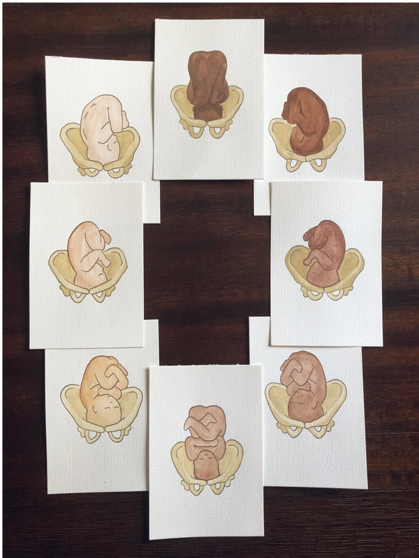 fetal positioning