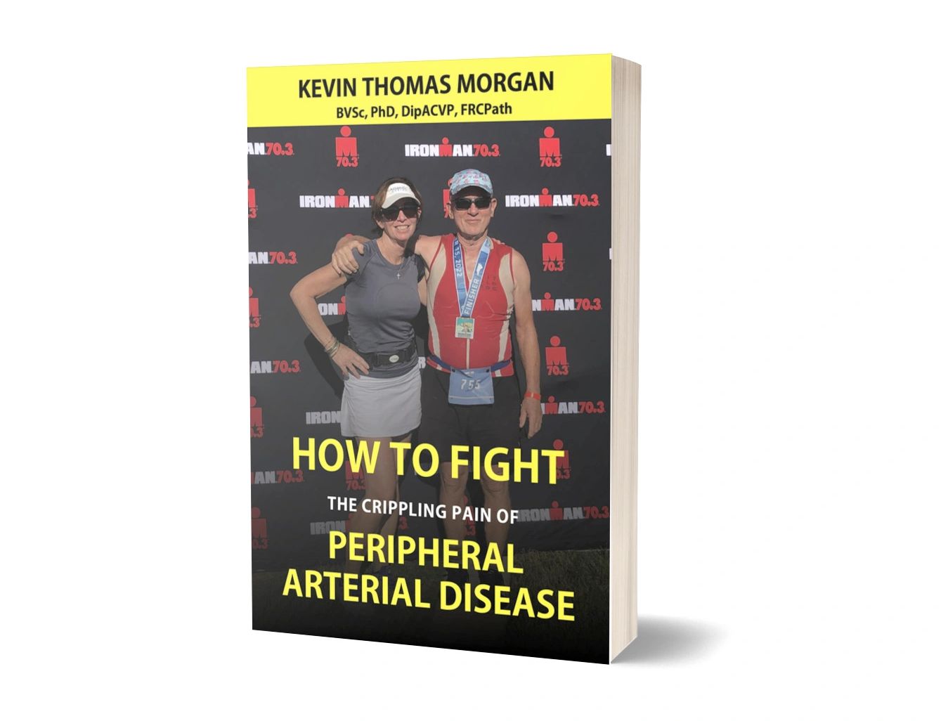 How to fight the crippling pain of peripheral artery disease. Arterial occlusive disease.