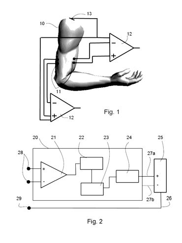 Diagram showing an arm with sensors connected to amplifiers and a circuit schematic.