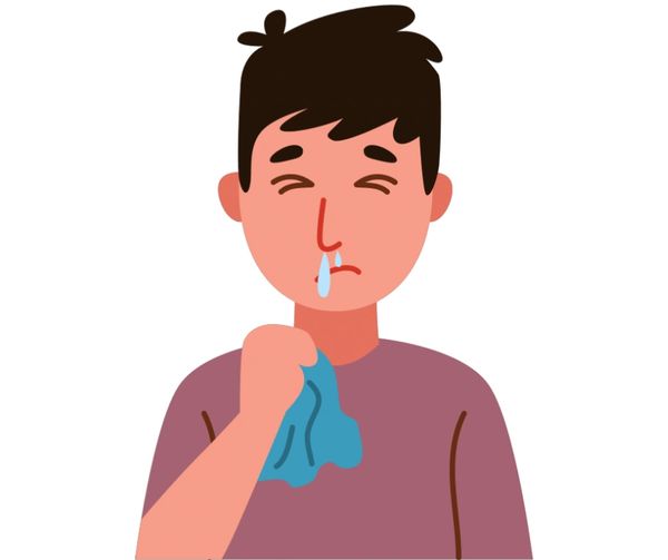 Rhinitis