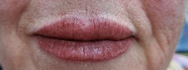 Después de la micropigmentación de Labios. Cambios inmediatos