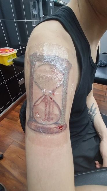Sesión de borrado de tatuaje recien hecha. Cubierto con parche protector.