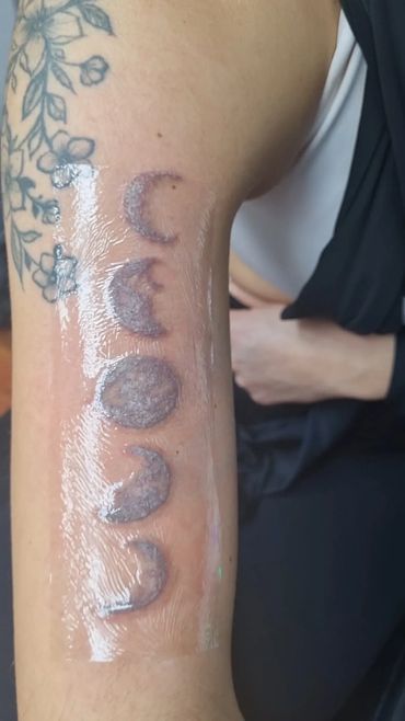 Sesión de Borrado de tatuaje recien hecha. Tatuaje ya cubierto con parche protector.