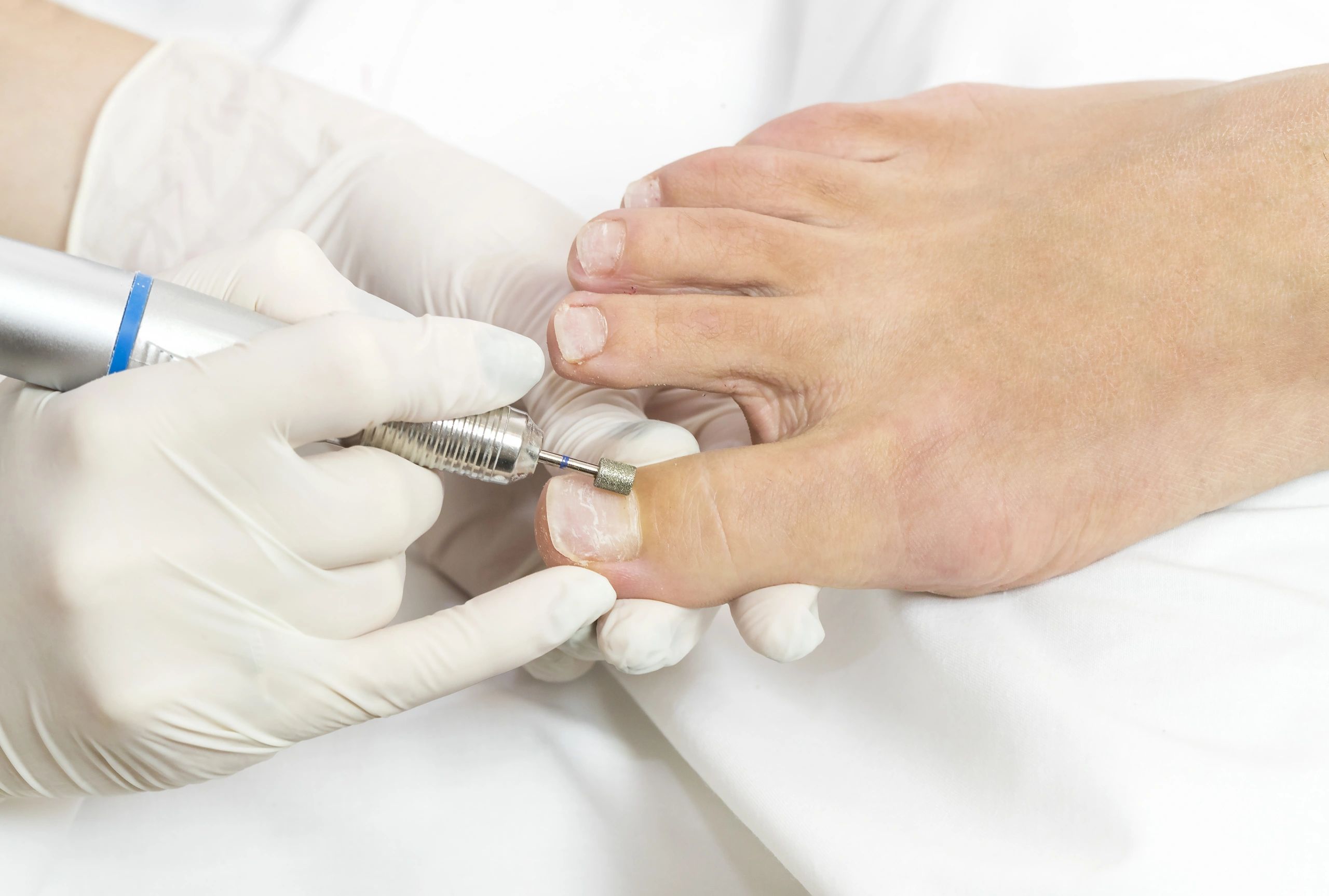 Routine footcare include debribing of toenails, trimming corns and calluses