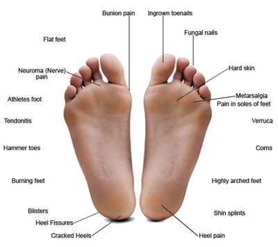 Common Foot Conditions