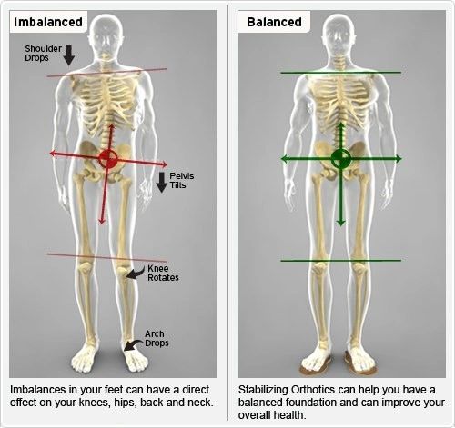 Low back pain, knee and hip pain caused by imbalance.