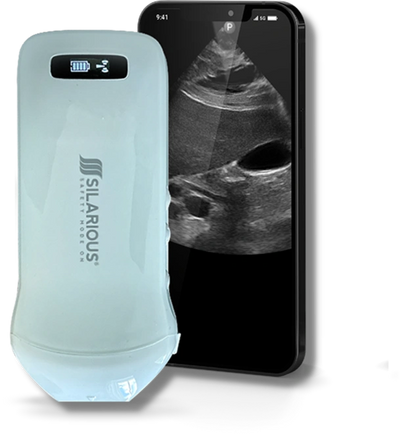 Silarious Ultrasound WiFi Scanner