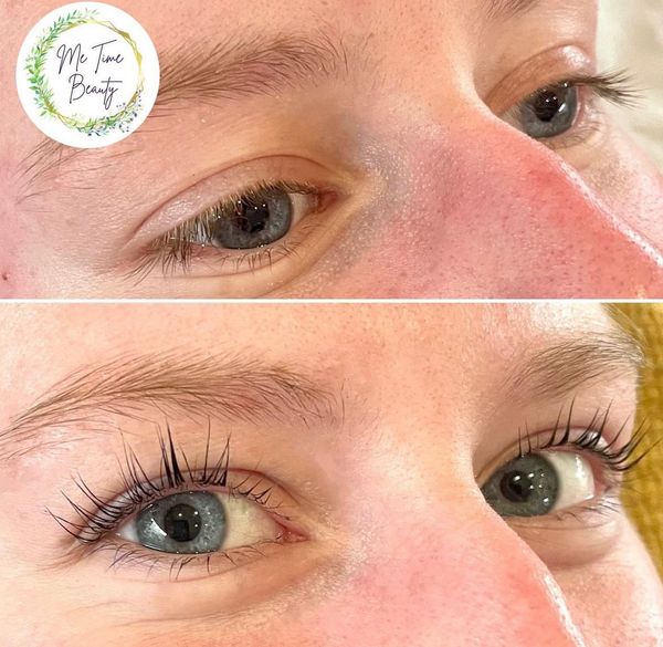 Eyelash lift