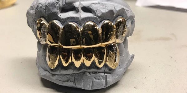 GRILLZ,LOUISVLLE KENTUCKY, ALLGOLDCUSTOMS,502,JEWELRY MUSIC AND CLUB WEAR.