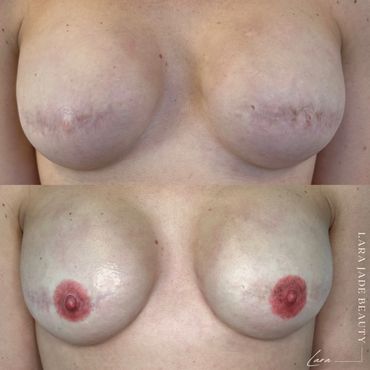 Areola Tattoo Toronto