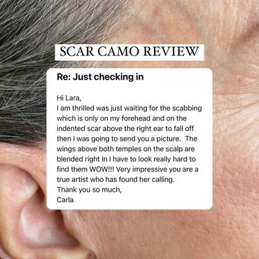 Scar camouflage review of happy client for Lara Jade Beauty in Toronto