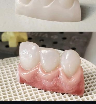 Two images showing dental prosthetics, one plain and one with realistic gum detail.