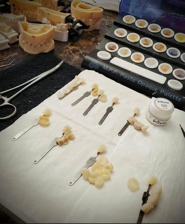 Dental shade guides and tools on a workspace for tooth color matching.