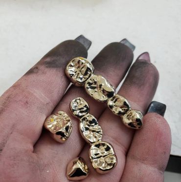 Hand holding shiny gold dental crowns with dirty fingers.