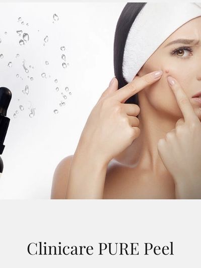 Chemical peel for beautiful skin. Anti-aging.