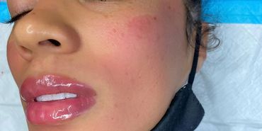 Daisy's first Lip Blush model in 2020.