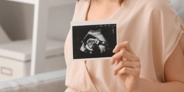 Expecting Mother