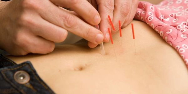 Acupuncture for fertility