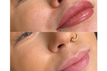 after before Lip Blush