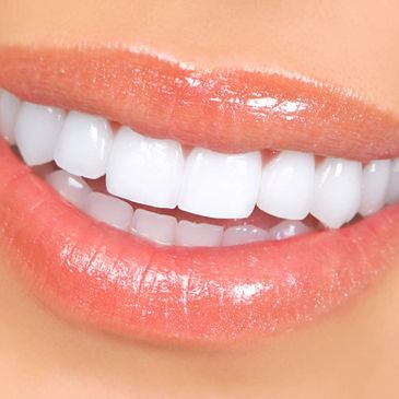 Loretta Chee DDS Dentist Irvine Restorative Dentistry