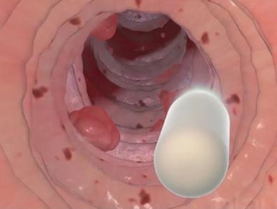 Veterinary endoscopy at Brighter Veterinary Center near Northridge, Porter Ranch, Granada Hills.