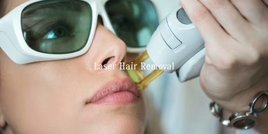 Close-up of laser hair removal treatment on upper lip.
