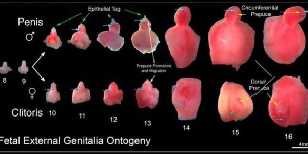 nub theory, genitalia, babys gender, nubs, early glimpse, baby girl, baby boy