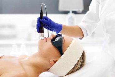 Woman receiving a facial laser treatment in a skincare clinic.