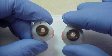 two ocular prosthetics with clear light pipes through the pupil