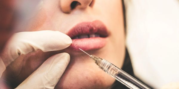 Injecting the lips with a dermal filler to enhance their appearance.