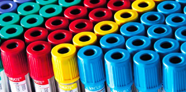Rows of colorful blood collection tubes with various caps.