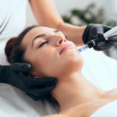 a woman getting a facial microneedling