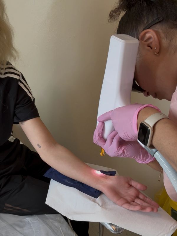 A person receiving a laser treatment on their forearm from a professional.