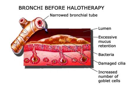 Action of salt therapy