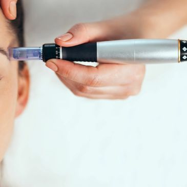 Microneedling course