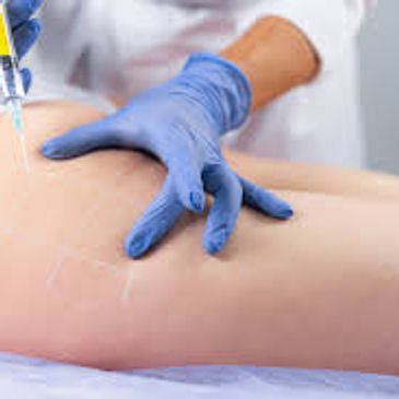 Fat dissolve injections