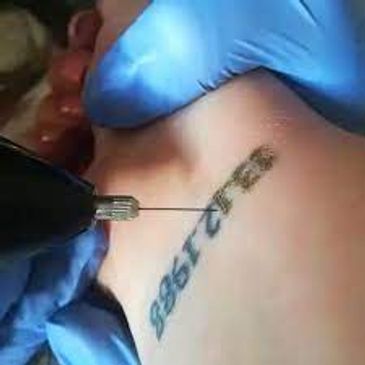 Tattoo removal course